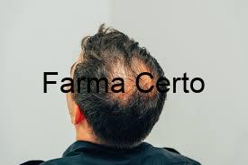 Calvície